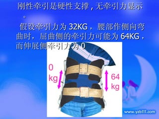 刚性牵引是硬性支撑 , 无牵引力显示。 假设牵引力为 32KG ，腰部作侧向弯曲时，屈曲侧的牵引力可能为 64KG ，而伸展侧牵引力为 0 64 kg 0 kg 