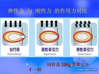 同样是 32kg 效果完全不一样 弹性力 与 刚性力 的作用力对比 