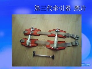 第三代牵引器 照片 