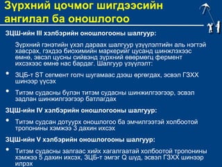 New зүрхний шигдээс | PPT