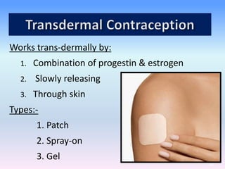 Works trans-dermally by:
1. Combination of progestin & estrogen
2. Slowly releasing
3. Through skin
Types:-
1. Patch
2. Spray-on
3. Gel
49
 