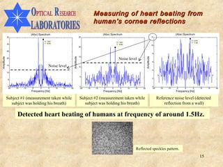 Measuring of heart beating from
                                                                                          human’s cornea reflections
                              (Abs) Spectrum                                                    (Abs) Spectrum                                                                     (Abs) Spectrum
            35                                                                25                                                                               12

                                        X: 1.502                                                                                                                                              X: 3.078
                                                                                                               X: 1.522                                                                       Y: 11.68
            30                          Y: 33.65
                                                                                                               Y: 19.96
                                                                                                                                                               10
                                                                              20

            25
                                                                                                                                                               8
                                                                              15




                                                                                                                                                   Amplitude
                                                                  Amplitude
                                                                                                                    Noise level
Amplitude




            20
                                                                                                                                                               6
            15
                                             Noise level                      10
                                                                                                                                                               4
            10

                                                                              5
                                                                                                                                                               2
            5


            0                                                                 0                                                                                0
            -20   -15   -10   -5    0       5      10   15   20               -20   -15   -10    -5        0        5          10        15   20               -20     -15   -10   -5    0     5         10   15   20
                              Frequency [Hz]                                                    Frequency [Hz]                                                                     Frequency [Hz]

            Subject #1 (measurement taken while                               Subject #2 (measurement taken while                                                    Reference noise level (detected
              subject was holding his breath)                                   subject was holding his breath)                                                          reflection from a wall)

                    Detected heart beating of humans at frequency of around 1.5Hz.
                                                                                    10



                                                                                    20



                                                                                    30



                                                                                    40




                                                                                                                                         Reflected speckles pattern.
                                                                                    50



                                                                                    60

                                                                                          10    20    30       40         50        60
                                                                                                                                                                                                         15
 