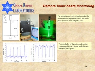 Remote heart beats monitoring


                                                                                                                  The implemented optical configuration for
                                                                                                                  remote measuring of heart beats and blood
                                                                                                                  pulse pressure from subject’s hand
                                Laser
            Camera




                                    50 cm




                         Hand




                    3
                                                                                2
                                                                                                                   Temporal plot of the outcome from the
                  2.5
                                                                                0
                                                                                                                   system used in the clinical trials for two
                    2
                                                                                                                   different participants.
                                                             Amplitude [pix]
Amplitude [pix]




                  1.5                                                           -2

                    1                                                           -4
                  0.5
                                                                                -6
                    0
                                                                                -8
                  -0.5
                                                                               -10
                   -1
                     0      1              2         3   4                           0   1       2        3   4
                                        Time [sec]                                           Time [sec]




                                                                                                                                                        18
 