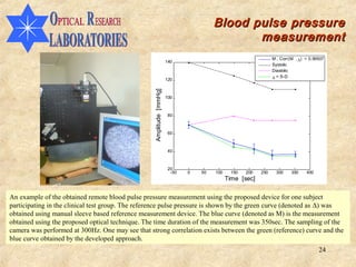 Blood pulse pressure
                                                                                              measurement
                                                                                                                M , Corr(M , ∆) = 0.99507
                                                                      140
                                                                                                                Systolic
                                                                                                                Diastolic

                                                                      120                                       ∆ = S-D




                                                   Amplitude [mmHg]
                                                                      100



                                                                       80



                                                                       60



                                                                       40



                                                                       20
                                                                        -50   0   50   100    150   200   250    300     350    400
                                                                                             Time [sec]

An example of the obtained remote blood pulse pressure measurement using the proposed device for one subject
participating in the clinical test group. The reference pulse pressure is shown by the green curve (denoted as ∆) was
obtained using manual sleeve based reference measurement device. The blue curve (denoted as M) is the measurement
obtained using the proposed optical technique. The time duration of the measurement was 350sec. The sampling of the
camera was performed at 300Hz. One may see that strong correlation exists between the green (reference) curve and the
blue curve obtained by the developed approach.
                                                                                                                                      24
 
