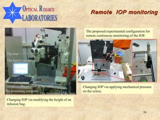 Remote IOP monitoring


                                                The proposed experimental configuration for
                                                remote continuous monitoring of the IOP.




                                              Changing IOP via applying mechanical pressure
                                              on the sclera.

Changing IOP via modifying the height of an
infusion bug.

                                                                                      26
 