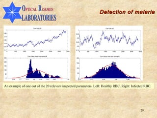 Detection of malaria




An example of one out of the 20 relevant inspected parameters. Left: Healthy RBC. Right: Infected RBC.




                                                                                              29
 