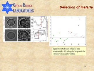 Detection of malaria




Separation between infected and
healthy cells. Plotting the length of the
vectors versus cells’ index.




                                       30
 