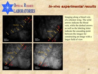 In-vivo experimental results


         Imaging along a blood vein
         of a chicken wing. The solid
         arrows indicate the blood
         vein, while the dashed arrows
         as well as the labeling letter
         indicate the cascading point
         between the images for
         constructing an image with a
         larger field of view




                                 43
 