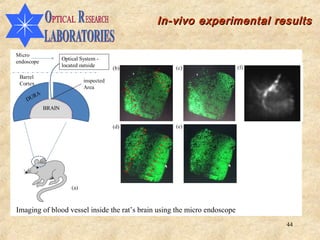 In-vivo experimental results




Imaging of blood vessel inside the rat’s brain using the micro endoscope
                                                                           44
 