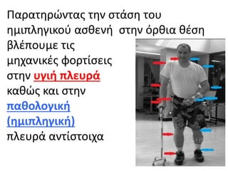 Παρατηρώντας την στάση του
ημιπληγικού ασθενή στην όρθια θέση
βλέπουμε τις
μηχανικές φορτίσεις
στην υγιή πλευρά
καθώς και στην
παθολογική
(ημιπληγική)
πλευρά αντίστοιχα
 