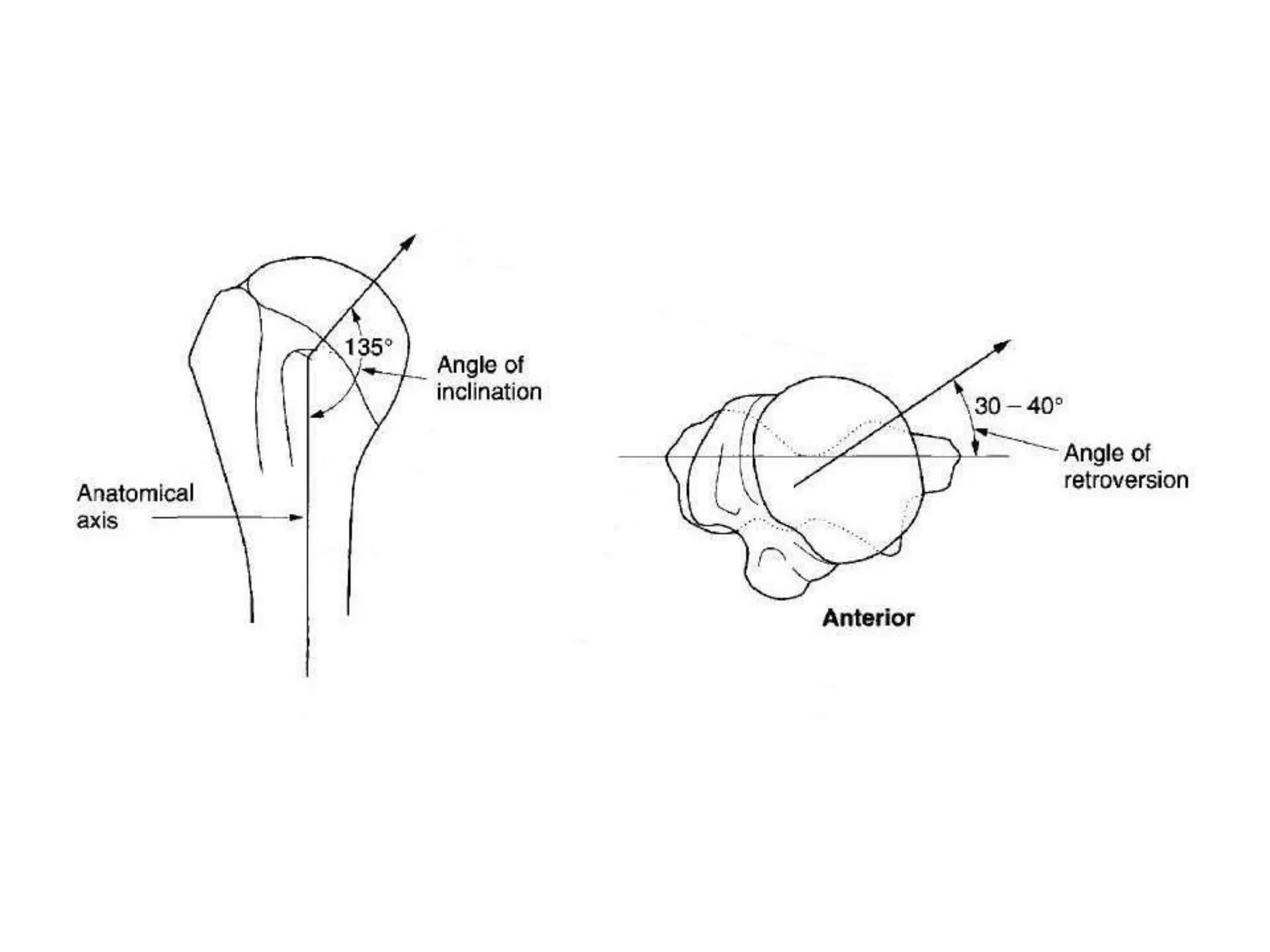 New advance shoulder arthroplasty | PPTX