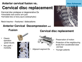 New AdvancesNew AdvancesAnterior cervical fusion vsAnterior cervical fusion vs..
Cervical disc replacementCervical disc re...