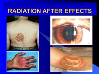RADIATION AFTER EFFECTS
RADIATION AFTER EFFECTS
 