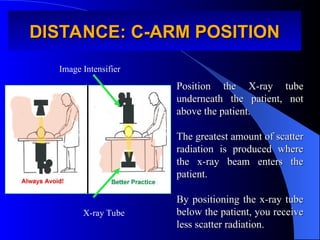 DISTANCE: C-ARM POSITION
DISTANCE: C-ARM POSITION
Position the X-ray tube
Position the X-ray tube
underneath the patient, not
underneath the patient, not
above the patient.
above the patient.
The greatest amount of scatter
The greatest amount of scatter
radiation is produced where
radiation is produced where
the x-ray beam enters the
the x-ray beam enters the
patient.
patient.
By positioning the x-ray tube
By positioning the x-ray tube
below the patient, you receive
below the patient, you receive
less scatter radiation.
less scatter radiation.
X-ray Tube
Image Intensifier
 