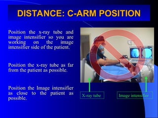 DISTANCE: C-ARM POSITION
DISTANCE: C-ARM POSITION
Position the x-ray tube and
Position the x-ray tube and
image intensifier so you are
image intensifier so you are
working on the image
working on the image
intensifier side of the patient.
intensifier side of the patient.
Position the x-ray tube as far
Position the x-ray tube as far
from the patient as possible.
from the patient as possible.
Position the Image intensifier
Position the Image intensifier
as close to the patient as
as close to the patient as
possible.
possible.
X-ray tube Image intensifier
 