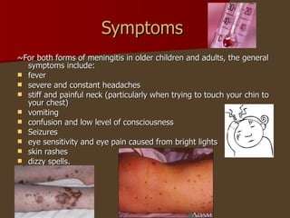 Symptoms  ~For both forms of meningitis in older children and adults, the general symptoms include:  fever severe and constant headaches stiff and painful neck (particularly when trying to touch your chin to your chest) vomiting confusion and low level of consciousness Seizures eye sensitivity and eye pain caused from bright lights skin rashes dizzy spells.  
