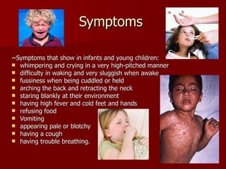 Symptoms  ~Symptoms that show in infants and young children:  whimpering and crying in a very high-pitched manner difficulty in waking and very sluggish when awake fussiness when being cuddled or held arching the back and retracting the neck staring blankly at their environment having high fever and cold feet and hands refusing food Vomiting appearing pale or blotchy having a cough having trouble breathing.  