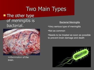 Two Main Types  The other type of meningitis is bacterial.  Bacterial Meningitis Very serious type of meningitis Not as common Needs to be treated as soon as possible to prevent brain damage and death inflammation  of the brain.  