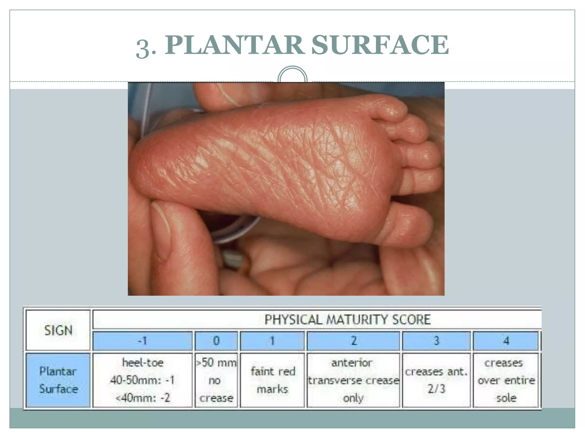 New ballard score PPTX