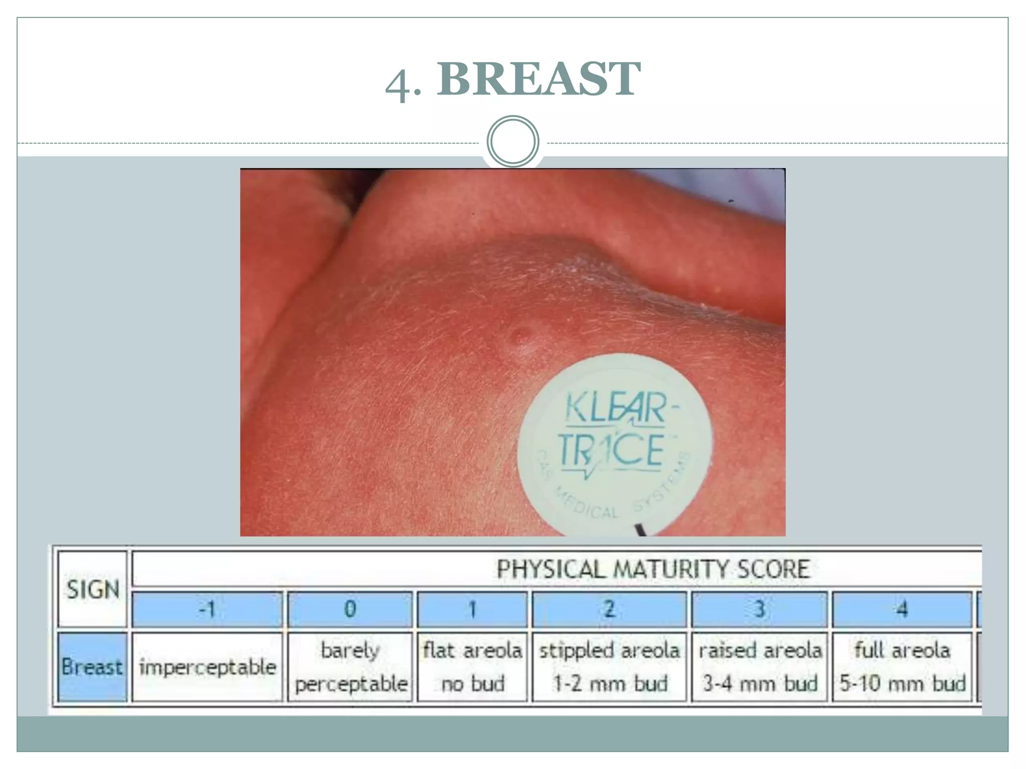 New ballard score PPTX