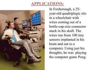 APPLICATIONS: 
In Foxborough, a 25- 
year-old quadriplegic sits 
in a wheelchair with 
wires coming out of a 
bottle-cap-size connector 
stuck in his skull. The 
wires run from 100 tiny 
sensors implanted in his 
brain and out to a 
computer. Using just his 
thoughts, he was playing 
the computer game Pong. 
 