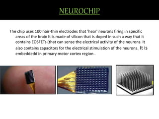 NEUROCHIP 
The chip uses 100 hair-thin electrodes that 'hear' neurons firing in specific 
areas of the brain It is made of silicon that is doped in such a way that it 
contains EOSFETs (that can sense the electrical activity of the neurons. It 
also contains capacitors for the electrical stimulation of the neurons. It is 
embeddedd in primary motor cortex region . 
 