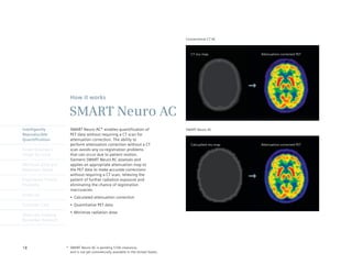 Conventional CT AC



                                                                                         CT mu-map           Attenuation-corrected PET




                        How it works

                       SMART Neuro AC
Intelligently           SMART Neuro AC* enables quantification of                     SMART Neuro AC
Reproducible            PET data without requiring a CT scan for
Quantification          attenuation correction. The ability to
                        perform attenuation correction without a CT                      Calcualted mu-map   Attenuation-corrected PET
Finest Volumetric       scan avoids any co-registration problems
Image Accuracy          that can occur due to patient motion.
                        Siemens SMART Neuro AC assesses and
Minimum Dose and        applies an appropriate attenuation map to
Maximum Speed           the PET data to make accurate corrections
                        without requiring a CT scan, relieving the
Engineered Clinical     patient of further radiation exposure and
Flexibility             eliminating the chance of registration
                        inaccuracies.
syngo.via
                        •	 Calculated	attenuation	correction
Customer Care           •	 Quantitative	PET	data
                        •	 Minimize	radiation	dose
Molecular Imaging
Biomarker Research




18                    * SMART Neuro AC is pending 510k clearance,
                        and is not yet commercially available in the United States.
 
