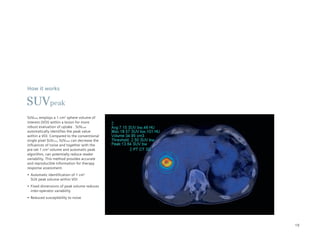 How it works

SUVpeak
SUVpeak employs a 1 cm3 sphere volume of
interest (VOI) within a lesion for more
robust evaluation of uptake . SUVpeak
automatically identifies the peak value
within a VOI. Compared to the conventional
single pixel SUVmax, SUVpeak can decrease the
influences of noise and together with the
pre-set 1 cm3 volume and automatic peak
algorithm, can potentially reduce reader
variability. This method provides accurate
and reproducible information for therapy
response assessment.
•	 Automatic	identification	of	1	cm3
   SUV peak volume within VOI
•	 Fixed	dimensions	of	peak	volume	reduces	
   inter-operator variability
•	 Reduced	susceptibility	to	noise




                                                19
 
