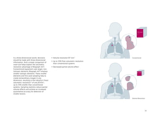 135 mm3




In a three-dimensional world, decisions         •	 Volume	resolution	87	mm3                 Conventional
should be made with three-dimensional
                                                •	 Up	to	35%	finer	volumetric	resolution	
information. And a simple comparison of
                                                   than conventional systems
voxel size helps explain the volumetric
resolution advantage of Biograph mCT.           •	 Decreased	partial	volume	effect
Conventional equipment uses larger, non-
isotropic elements; Biograph mCT employs
                                                                                                  87 mm3
smaller isotropic elements. These smaller
elements and fine axial sampling help to
create extraordinary images in any
dimension, resulting in the industry’s finest
volumetric resolution* of only 87mm3,
up to 35% smaller than conventional
systems. Sampling statistics reduce partial
volume effects and achieve an increased
quantitative accuracy for detection of
smaller lesions.

                                                                                            Volume Resolution




                                                                                                            31
 