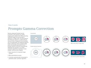 How it works

Prompts Gamma Correction
Siemens	patented	Prompts	Gamma	                 Conventional
Correction is the solution for cardiac
imaging with rubidium-82 (82Rb), providing
improved image accuracy through a
reduction in image noise. The third gamma
that 82Rb emits results in a additional and
incorrect lines of response to be calculated.
Left	uncompensated,	this	additional	gamma	
leads to distortions with increased image                                  More noise reduces image clarity
noise and possible quantitative errors.
Prompts	Gamma	Correction	automatically	         Prompts	Gamma	Correction
addresses this anomaly in its scatter
correction algorithms, resulting in more
reliable, more accurate imaging.
•	 Noise	reduction	for	improved	image	
   contrast
•	 More	quantitative	accuracy
                                                                           Less	noise	for	greater	image	clarity
•	 Correction	automatically	incorporated	in	
   patented scatter correction algorithm




                                                                                                              33
 