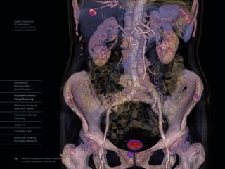 Superb visualization
of small tumors
with industry-leading
volumetric resolution*




Intelligently
Reproducible
Quantification

Finest Volumetric
Image Accuracy

Minimum Dose and
Maximum Speed

Engineered Clinical
Flexibility

syngo.via

Customer Care

Molecular Imaging
Biomarker Research




40 * Based on competitive literature available
       at time of publication. Data on file.
 