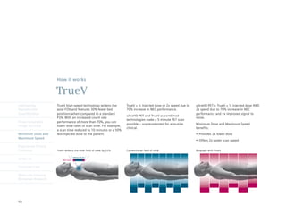How it works

                      TrueV
Intelligently         TrueV high-speed technology widens the        TrueV = ½ injected dose or 2x speed due to   ultraHD·PET + TrueV = ½ injected dose AND
Reproducible          axial FOV and features 30% fewer bed          70% increase in NEC performance.             2x speed due to 70% increase in NEC
Quantification        positions when compared to a standard                                                      performance and 4x improved signal to
                                                                    ultraHD·PET and TrueV as combined
                      FOV. With an increased count rate                                                          noise.
                                                                    technologies make a 5-minute PET scan
Finest Volumetric     performance of more than 70%, you can
                                                                    possible – unprecedented for a routine       Minimum Dose and Maximum Speed
Image Accuracy        lower dose rates of scan time. For example,
                                                                    clinical.                                    benefits:
                      a scan time reduced to 10 minutes or a 50%
Minimum Dose and      less injected dose to the patient.                                                         •	 Provides	2x	lower	dose
Maximum Speed
                                                                                                                 •	 Offers	2x	faster	scan	speed
Engineered Clinical
Flexibility           TrueV widens the axial field of view by 33%   Conventional field of view                   Biograph with TrueV


syngo.via

Customer Care

Molecular Imaging
Biomarker Research




50
 
