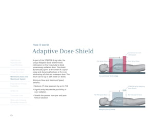 How it works

                      Adaptive Dose Shield                                                                   Conventional tube
                                                                                                             collimation


Intelligently         As part of the STRATON X-ray tube, the               Pre-Spiral Dose                   Post-Spiral Dose
Reproducible          unique Adaptive Dose Shield moves
Quantification        collimators on the X-ray tube to block
                                                                                                Image area
                      unnecessary radiation dose. The shield
Finest Volumetric     dynamically opens at the onset of a spiral
Image Accuracy        range and dynamically closes at the end,
                      eliminating all clinically irrelevant dose. The
                                                                              Conventional Technology
Minimum Dose and      result can be up to 25% lower CT doses.
Maximum Speed
                      Minimum Dose and Maximum Speed
                      benefits:
Engineered Clinical
Flexibility           •	 Reduces	CT	dose	exposure	by	up	to	25%                                               STRATON with Adaptive
                                                                                                             Dose Shield
                      •	 Significantly	reduces	the	possibility	of	
syngo.via
                         over-radiation
Customer Care         •	 Shields	the	patient	from	pre-	and	post-        No Pre-Spiral Dose                   No Post-Spiral Dose
                         helical radiation
Molecular Imaging                                                                               Image area
Biomarker Research


                                                                              Adaptive Dose Shield


52
 