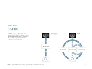 How it works

 SAFIRE
  SAFIRE* – Sinogram Affirmed Iterative                                                                     Standard Filtered                                       SAFIRE
  Reconstruction – should allow you to utilize                                                              Back Projection
  raw-data information (which is visualized in
  the so-called sinogram) in the iterative
  image reconstruction process.




                                                                                           Raw data recon


                                                                                                                                Raw data recon   Image data recon     Image correction




* SAFIRE is pending 510k clearance, and is not yet commercially available in the United States.                                                                                     53
 