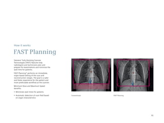 How it works

FAST Planning
Siemens’ Fully Assisting Scanner
Technologies (FAST) features help
radiologists and technicians plan and
prepare for examinations and minimize the
wait time for patients.
FAST Planning* performs an immediate,
organ-based setting of the scan and
reconstruction ranges. The goal is a safer
and faster experience for the patient and
more predictable workflow at the scanner.
Minimum Dose and Maximum Speed
benefits:
•	 Minimizes	wait	times	for	patients
•	 Automatic	detection	of	scan	field	based	   Conventional   FAST Planning
   on organ characteristics




                                                                             55
 