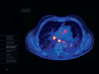 Superb image quality
                      with 1/2 injected dose
                      using TOF technology




Intelligently
Reproducible
Quantification

Finest Volumetric
Image Accuracy

Minimum Dose and
Maximum Speed

Engineered Clinical
Flexibility

syngo.via

Customer Care

Molecular Imaging
Biomarker Research




56
 