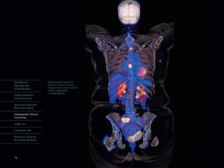 Intelligently         Advanced technologies for
Reproducible          bariatric imaging including
                      high generator power provides
Quantification
                      superb image quality
                       in obese patients
Finest Volumetric
Image Accuracy

Minimum Dose and
Maximum Speed

Engineered Clinical
Flexibility

syngo.via

Customer Care

Molecular Imaging
Biomarker Research




70
 