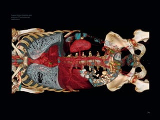Expand clinical flexibility with
premium CT and advanced
applications




                                   71
 