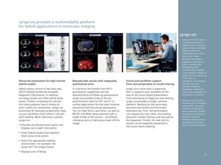 syngo.via provides a multimodality platform
for hybrid applications in molecular imaging

                                                                                                                                      syngo.via
                                                                                                                                      •	 syngo.via can be used as
                                                                                                                                         a standalone device or
                                                                                                                                         together with a variety of
                                                                                                                                         syngo.via based software
                                                                                                                                         options, which are
                                                                                                                                         medical devices in their
                                                                                                                                         own rights. These
                                                                                                                                         products are pending
                                                                                                                                         regulatory clearance in
                                                                                                                                         some countries and
                                                                                                                                         therefore not yet
                                                                                                                                         commercially available
                                                                                                                                         in all countries. Usage of
                                                                                                                                         syngo.via in an operating
                                                                                                                                         room or for an
Advanced automation for high-volume         Reproducible results with integrated,         End-to-end workflow support                    emergency case requires
hybrid studies                              quantitative tools                            from case preparation to results sharing       that the customer
                                                                                                                                         provides respective
Hybrid exams consist of two data sets,      To maximize the benefit from PET’s            syngo.via is more than a diagnostic            emergency measure in
which already double the available          quantitative capabilities and the             tool: it supports your workflow all the        case of non-availability of
diagnostic information. In addition,        reproducibility of follow-up assessments,     way to the tumor board presentation.           the system or network.
oncology studies are often whole-body       syngo.via provides state-of-the-art           From processing to diagnosis and sharing,
                                                                                                                                      •	 syngo.via can be used
exams, further increasing the volume.       quantification tools for PET and CT in        syngo.via provides a single common
                                                                                                                                         anywhere if the following
And many patients have a history of         unified applications for the most intuitive   platform. Working on the same data             prerequisites are given:
prior studies for comparison. syngo.via     anatomical and functional assessment.         set preserves results and eliminates           Internet connection to
automates all necessary preparation steps   You can take SUVpeak and SUVmax as well as    redundancies. First, the technologist          clinical network, DICOM
so your workflow starts where it should –   RECIST and WHO measurements with a            can prepare the case. Next, the reading        compliance, meeting of
with reading. When selecting a patient,     single stroke of the mouse – all without      physician creates findings and documents       Siemens minimum
syngo.via:                                  changing tools or taking your eyes off the    the diagnosis. Finally, the case and its       hardware requirements,
                                                                                                                                         and adherence to local
                                            image.                                        results can be elegantly presented in
•	 Provides	pre-fetched	prior	exams	and	                                                                                                 data security regulations.
                                                                                          the tumor board meeting.
   displays up to eight time points
•	 Fuses	hybrid	studies	and	registers	
   them across time points
•	 Starts	the	appropriate	reading	
   environment: for example, the
   syngo.mCT Oncology Engine
•	 Displays	prior	findings
                                                                                                                                                                73
 