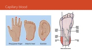 Capillary blood
 