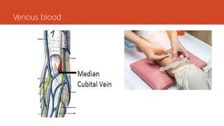 Venous blood
 