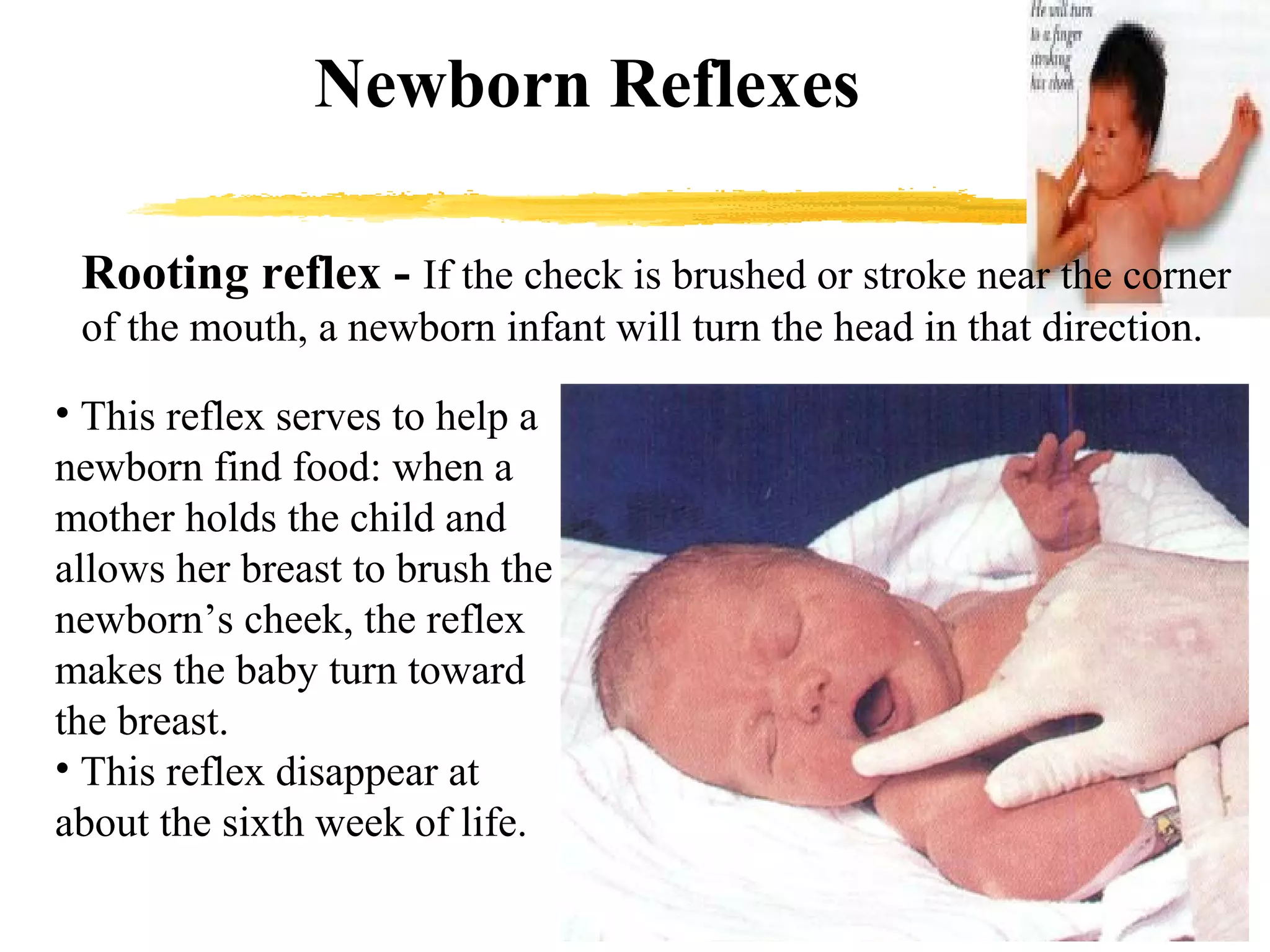 Newborn | PPT