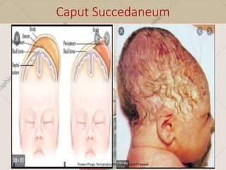 Newborn-Assessment.pptx