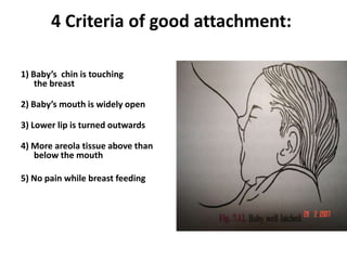 4 Criteria of good attachment:

1) Baby’s chin is touching
    the breast

2) Baby’s mouth is widely open

3) Lower lip is turned outwards

4) More areola tissue above than
   below the mouth

5) No pain while breast feeding
 