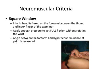 Gestational age assessment and Neonatal reflexes | PPTX