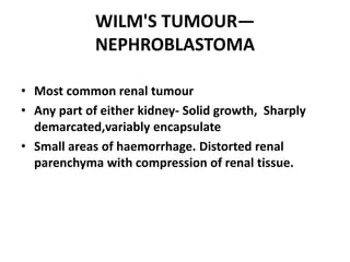 WILM'S TUMOUR—
             NEPHROBLASTOMA

• Most common renal tumour
• Any part of either kidney- Solid growth, Sharply
  demarcated,variably encapsulate
• Small areas of haemorrhage. Distorted renal
  parenchyma with compression of renal tissue.
 