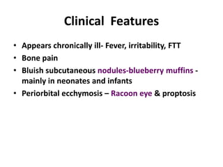 Clinical Features
• Appears chronically ill- Fever, irritability, FTT
• Bone pain
• Bluish subcutaneous nodules-blueberry muffins -
  mainly in neonates and infants
• Periorbital ecchymosis – Racoon eye & proptosis
 