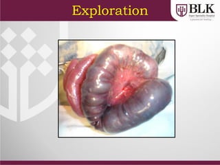 Exploration
 