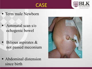 CASE
 Term male Newborn
 Antenatal scan s/o
echogenic bowel
 Bilious aspirates &
not passed meconium
 Abdominal distension
since birth
 