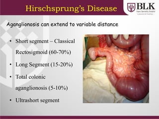 Aganglionosis can extend to variable distance
• Short segment – Classical
Rectosigmoid (60-70%)
• Long Segment (15-20%)
• Total colonic
aganglionosis (5-10%)
• Ultrashort segment
Hirschsprung’s Disease
 